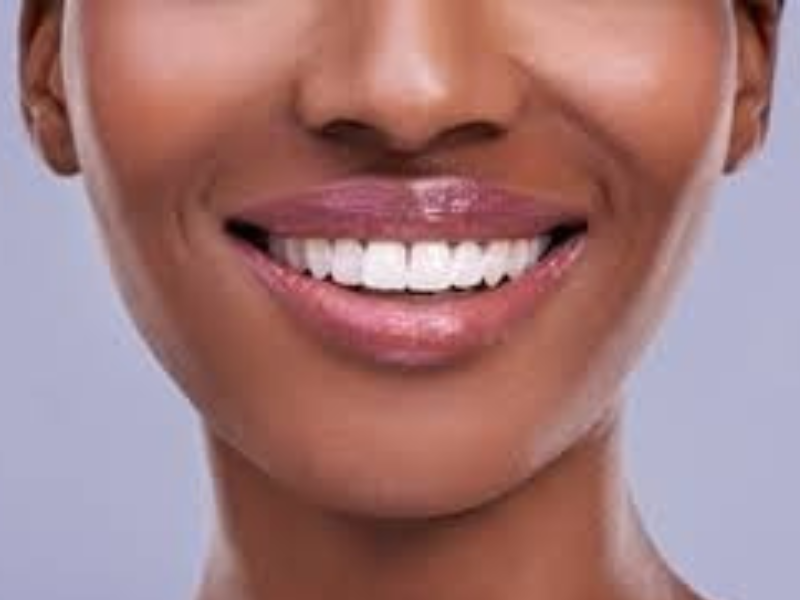 Smile Story Image